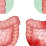 Gut Health And Nutrition