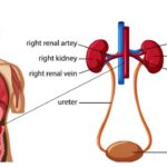 Does Chronic Kidney Disease Cause Low Platelets