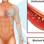 Fat Consumption on Heart Health