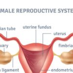 Can A Woman Have Prostate Cancer