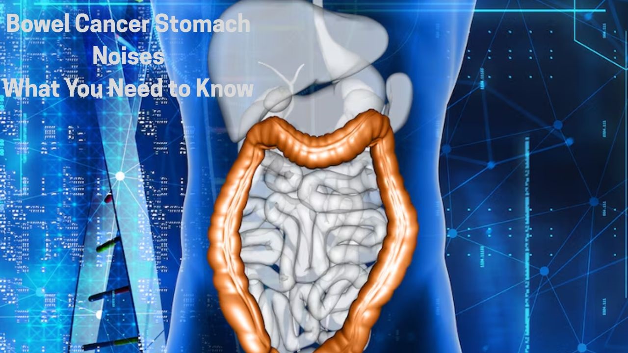 Bowel Cancer Stomach Noises What You Need to Know(02)