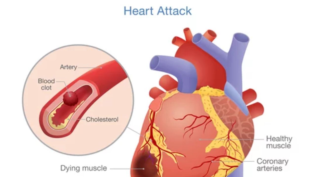 Early Warning Signs of Heart Disease
